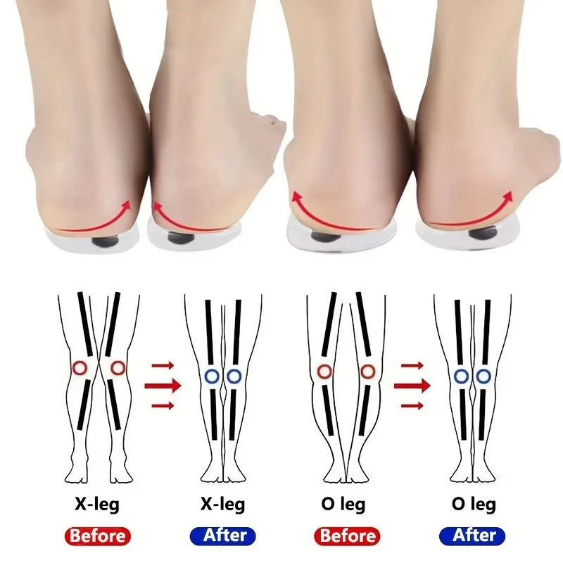 1Pair Orthopedic Insoles for F - đánh giá và giá Women Shoes Types