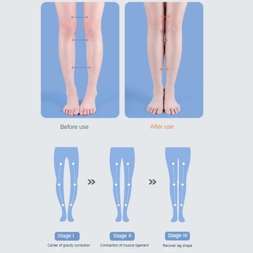 PU Orthotic Insole Arch Suppor - đánh giá và giá Women Shoes Types